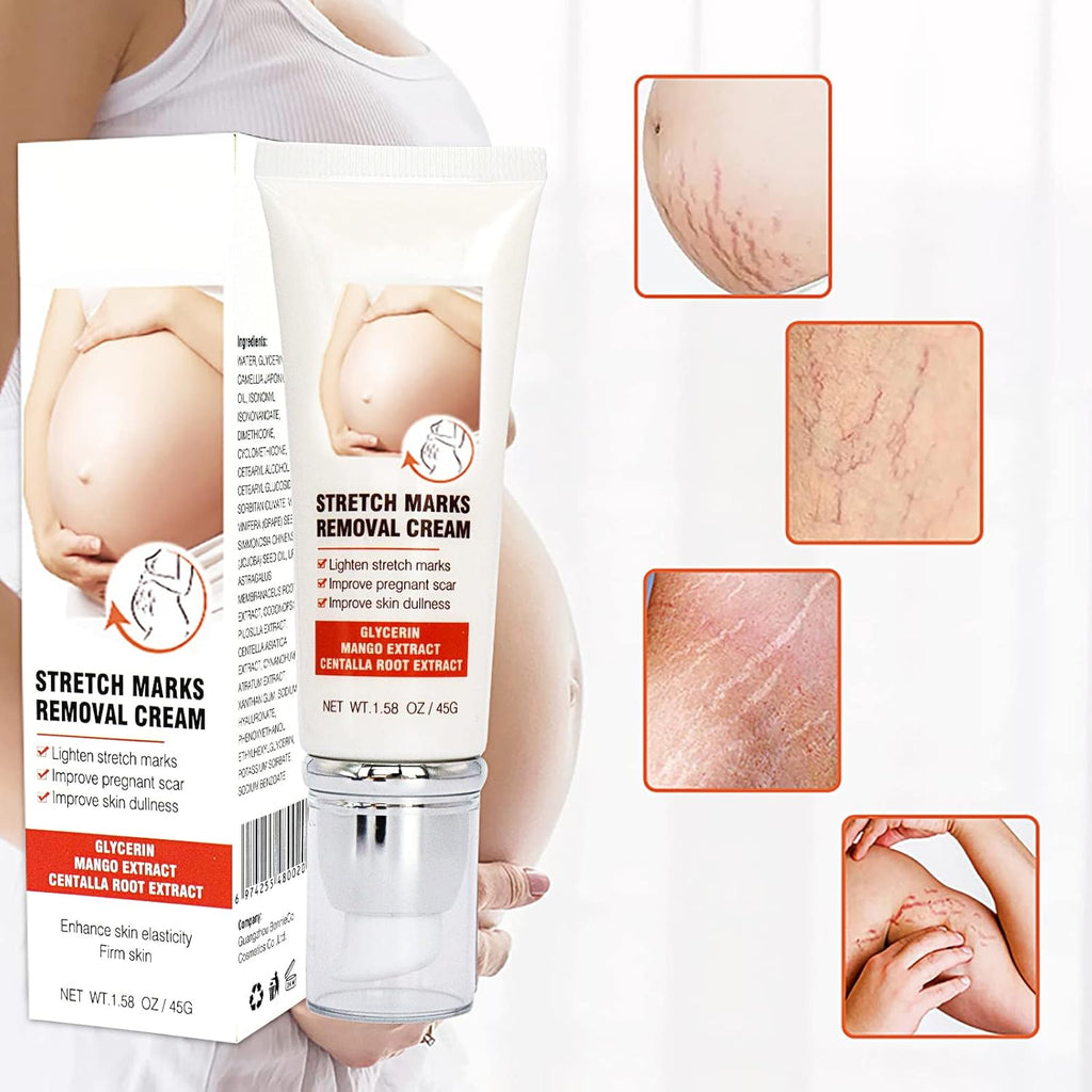 Vergetures Grossesse, Creme Vergeture Grossesse, Creme anti Vergeture Crème Raffermissante Corps, Réduction Des Vergetures Pour Les Femmes Après La Grossesse, 45 G